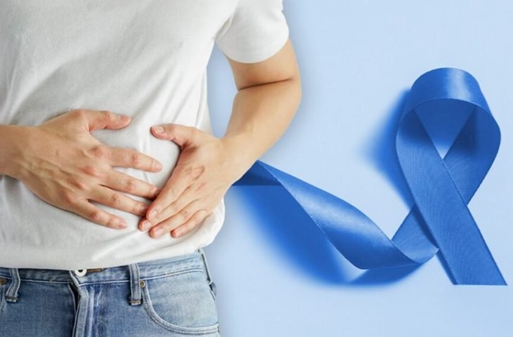 Especialista da SES alerta para câncer de intestino: rastreamento deve começar aos 45 anos